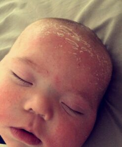 Cetaphil Pro Restoraderm Gentle Body Moisturizer, Eczema Calming, 10-Fluid Ounces 10 Ounce (Pack of 1) 23 71C3HDa8NyL