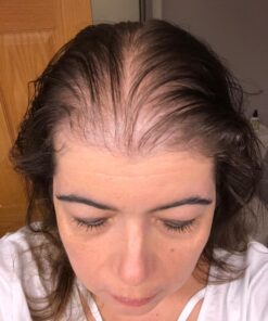 XFusion Keratin Hair Fibers - Black (Large Size 28g) Medium Brown 38 71C9he6aCgL