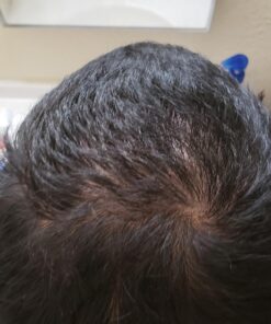 artnaturals Argan Hair Growth Shampoo - (16 Fl Oz / 473ml) - Sulfate Free - Treatment for Hair Loss, Thinning & Regrowth - Men & Women - Infused with Biotin, Argan Oil, Keratin, Caffeine 40 71CGgu08tOL