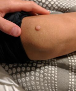 Compound W One Step Wart Remover Strips for Kids, 10 Medicated Strips for Wart Removal, 2 Pack unflavored 10 Count (Pack of 2) 51 71CP8MRSq9L