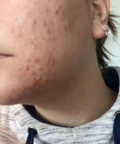 Alani Nu Balance | Supplement for Women | Hormonal Support | Weight Management and Clear Complexion | Gluten Free | Vegan | Sugar Free | 120 Veggie Capsules | 30 Day Supply Unflavored 42 71CZ9Ykp9pL