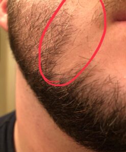 Alternative view of Growth Treatment Unscented 5% (Foam) 2 Ounce (Pack of 1)