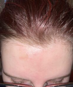 Terrasil Wound Care - 3X Faster Healing, Infection Protection Ointment for bed sores, pressure sores, diabetic wounds, ulcers, cuts, scrapes, and burns (14 gram tube) 33 71CyDZfJzzL