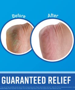 O'Keeffe's for Healthy Feet Foot Cream, Guaranteed Relief for Extremely Dry, Cracked Feet, Instantly Boosts Moisture Levels, 3.2 Ounce Jar, (Pack of 1) 3.2 Ounce (Pack of 1) 23 71DcLSsC5YL