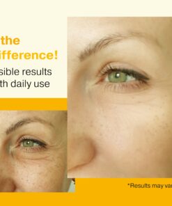 Double Size (2OZ), 20% Vitamin C Serum for Face with Hyaluronic Acid, Face Serum Vitamin C, Vitamin C for Face Serum for Women, Vitamin C Oil for Face, Vit C Serum for Face, Vitamin C Face Serum Vitamin C Serum 20% 23 71EQfz cnL