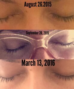 Home Health Original Castor Oil - 32 Fl Oz - Promotes Healthy Hair & Skin, Natural Skin Moisturizer - Pure, Cold Pressed, Non-GMO, Hexane-Free, Solvent-Free, Paraben-Free, Vegan (50132) 50 71EsWOPnJoL 1