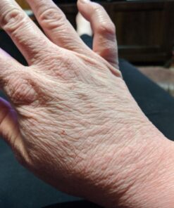 O'Keeffe's Working Hands Hand Cream, Relieves and Repairs Extremely Dry Hands, 3 oz Tube, (Pack of 2) 3 Ounce (Pack of 2) 42 71FFCozUuIL