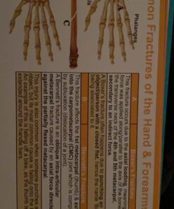 Occupational Therapy Reference Pocket Guide - Must Have OT Resource, 32 Pages OT Quick Tips for OT Student Occupational Therapist Gifts, 17 Cards Perfect Pocket Sized 3"×5" - General Adult Rehab Set 23 71FLcpn7v1L