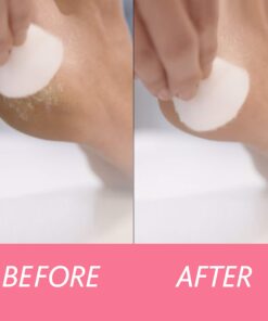 Amope Pedi Perfect Electronic Foot File, Dual-Speed Callus Remover (with Diamond Crystals) for Feet (Extra Coarse - Pink Gadget). -Perfect for In-home Pedicure for Baby Smooth Feet. Battery Operated 27 71Fl7QWsdjL