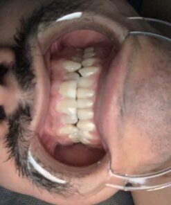 TheraBreath Healthy Gums Mouthwash, Clean Mint, Antigingivitis, Dentist Formulated, 16 Fl Oz (2-Pack) 16 Fl Oz (Pack of 2) 36 71G7FXygwFL