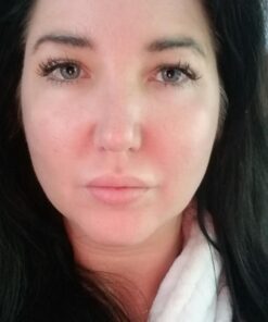 Glycolic Acid 30% Gel Peel with Chamomile and Green Tea Extracts - Professional Grade Chemical Face Peel for Acne Scars, Collagen Boost, Wrinkles, Fine Lines - Alpha Hydroxy Acid - 1 Bottle of 1 fl oz 1 Fl Oz (Pack of 1) 28 71GOqQBZ4zL