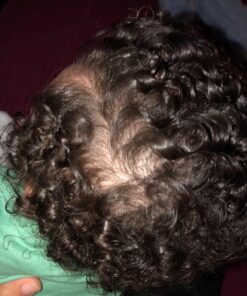 Frida Baby DermaFrida The SkinSoother Baby Bath Silicone Brush| Baby Essential for Dry Skin, Cradle Cap and Eczema (2 Pack) Blue 2 pack 35 71GVZ2m034L