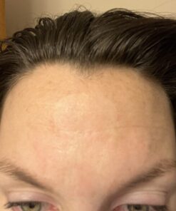 Toute Nuit Wrinkle Patches, Face Tape, Jet - Extra Large UNISEX Frown Lines Plus and Forehead - 20 Patches 21 71GwNIkX3L