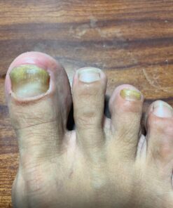 3 in 1 Professional Foot Spa Kit-with Tea Tree Foot & Body Soak-Tea Tree Body Wash & Nail Blend-Soothes Dry, Burning & Itchy Skin-Refreshes Unwanted Foot Odor-Restores Unhealthy Nails-Purely Northwest Tea Tree Oil 3 Piece Set 47 71HQ3wLnFKL