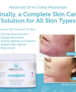 Era Organics Manuka Honey Face Cream - Advanced 12-in-1 Nourishing and Rejuvenating Daily Face Moisturizer for Women and Men - Face Moisturizer for Sensitive Skin - Body Moisturizer for Dry Skin 4 oz Regular 4 Ounce (Pack of 1) 27 71HYbX0tL0L