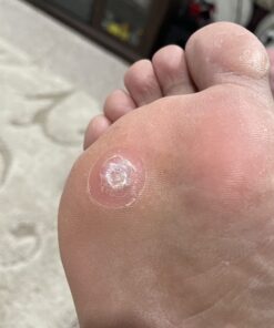 Dr. Scholl's Dual Action Freeze Away WART Remover, 8 Applications // Freeze Therapy + Powerful Fast Acting Salicylic Liquid to Remove Common and Plantar Warts, 0.33 Fl Oz, 1 Count 54 71Hwg06 xyL