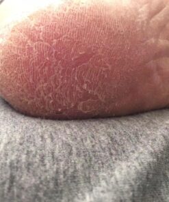 Plant Therapy Organic Tea Tree Oil (Melaleuca) 100% Pure, USDA Certified Organic, Undiluted, Natural Aromatherapy, Therapeutic Grade 10 mL (1/3 oz) 18 71I7TBjZqEL