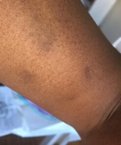 Go Nutrients Intestinal Edge Gut Detox Cleanse for Humans: Enhance Digestive Health, Boost Energy, Clear Skin with Black Walnut, Wormwood, Clove & Gentian Root for Adults & Kids 2oz Liquid Drops 38 71IFNNcpnPL