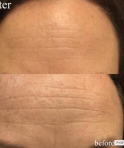 L’Oréal Paris Age Perfect Eye Renewal Cream, 0.5 fl oz - Anti-Aging for Mature Skin 21 71Ie9ZJeeyL