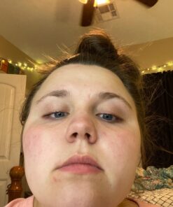 TruSkin Vitamin C Face Serum – Anti Aging Face & Eye Serum with Vitamin C, Hyaluronic Acid, Vitamin E – Brightening Serum, Dark Spot Remover, Even Skin Tone, Eye Area, Fine Lines & Wrinkles, 1 Fl Oz 1 Fl Oz (Pack of 1) 51 71Iix7qB1jL