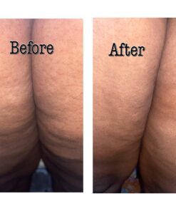 Nivea Skin Firming and Toning Body Gel Cream with Q10, Firming Body Cream, Moisturizing Skin Cream, 6.7 Oz Tube Skin Firming Gel 49 71J PsvIeOL