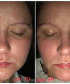 Radha Beauty Moisturizing Miracle Retinol Cream for Face - with 2.5% Retinol, Hyaluronic Acid, Vitamin E and Green Tea. Luxury Night and Day Anti-Aging Wrinkle Cream 1.7 fl oz. 33 71Ju6zrB4mL