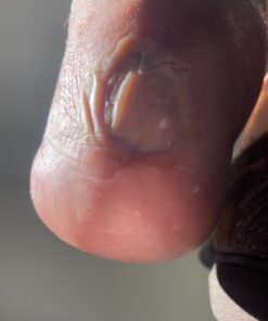 Terrasil Wound Care - 3X Faster Healing, Infection Protection for Bed sores, Pressure sores, Diabetic Wounds, Foot, Leg ulcers, cuts, scrapes, Burns - 50gm Tube 25 71K0 wxinfL