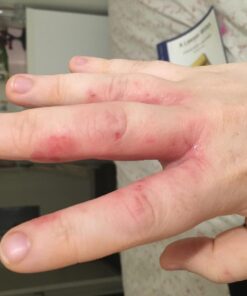 MIZON Snail Line Gift Set, Skincare Set, Set of Two Snail Recovery Gel Cream, Wrinkle Care, Skin Elasticity, Moisture, Fragrance-Free, Paraben-Free (45ml 1.52 fl.oz -Pack of 2) 2 Count (Pack of 1) 45 71KUbhImcL