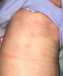 Cetaphil Pro Restoraderm Gentle Body Moisturizer, Eczema Calming, 10-Fluid Ounces 10 Ounce (Pack of 1) 24 71KV6hR7XPL