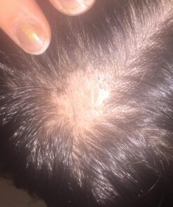 Nourish Beaute Hair Regrowth Treatment Serum for Hair Loss, Volume and Thickening with Caffeine for Men and Women, 1.7 Oz 25 71KWSKLehPL