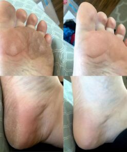 Amope Pedi Perfect Electronic Foot File, Dual-Speed Callus Remover (with Diamond Crystals) for Feet (Extra Coarse - Pink Gadget). -Perfect for In-home Pedicure for Baby Smooth Feet. Battery Operated 38 71KlqAhHWZL