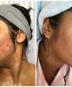 Obagi Medical CLENZIderm M.D. System Pack of 1 26 71KnbtrdNiL