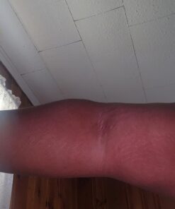 Eveline Slim Extreme 4D Liposuction Body Serum, Firming Body Lotion for Women and Men and Body Sculpting Cellulite Workout Cream 39 71KuCW 3bRL