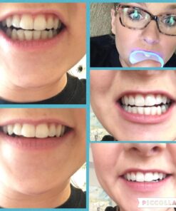 Remineralization Gel - 5 Syringes of Gel. Remineralizing and Reduces Teeth Sensitivity After Teeth Whitening Treatment 20 71LIzPh7N1L