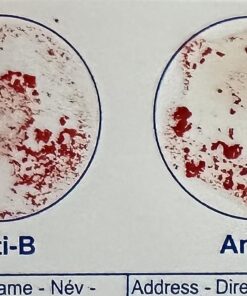 Eldoncard Blood Typing Kit, 3 Tests, Know Your Blood Type, Instant Home Testing Kit, A, O, B, Rhs-D Negative and Positive Blood Types Tested For 25 71LKHJQ2BIL