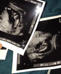 Conceive Plus Fertility Supplements for Men, Male Fertility Booster Prenatal – Optimal Sperm Count & Motility - Maca, L-Arginine, Zinc, Folate Folic Acid & Magnesium – 60 Vegetarian Soft Blue Capsules 40 71LKbzpBWGL 2