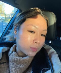 Face & Body Clearing Serum, Level 1- for acne, folliculitis, aging skin, ingrown hairs, dark spots - face, chest, butt, back, thighs, arms - mandelic acid - 1 fl oz 1 Fl Oz (Pack of 1) 29 71LReFf1TIL