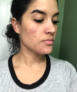 NOW Foods Supplements,Pantothenic Acid (Vitamin B-5) 500 mg,B-Complex Vitamin,250 Capsules 250 Count (Pack of 1) 34 71LWSNxHtgL