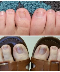 NZ Country Manuka Oil | 100% Pure Organic Essential Oil | Natural and Effective Skin Care | Plant Therapy Essential Oils for Body, Nails, Hair, Skin & Lips | 35x Stronger Than Organic Tea Tree Oil 35 71LiEYGPCfL