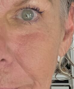 DuoDERM Extra Thin CGF Hydrocolloid 4"x4" Sterile Self-Adhesive Dressing for Management of Lightly Exuding Wounds, Flexible, Latex-Free, Beige, 187955, Box of 10 4x4 Inch (Pack of 10) 19 71MEVy3zv9L