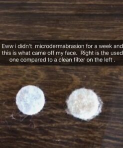 Kendal Professional Diamond Microdermabrasion Machine, Dermabrasion Facial Skin Care Equipment, Also Good for Home Use AC 110V HB-SF01 54 71MGgmJ6gAL