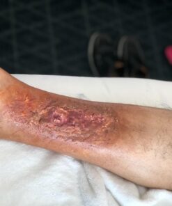 Smooth-On Skin Tite Ultimate Wound Kit 7 71MNetgzOML