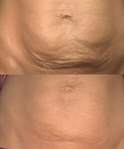 Anti Cellulite Massage Oil Infused with Collagen & Stem Cell Instant Toning Firming of Cellulite & Scar Remover for Thighs & Body Relaxing Sore Muscle Massage Therapy Cream by M3 Naturals 8 Fl Oz (Pack of 1) 37 71Me84hOjCL