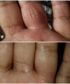 Moisturising Cream, Body and Face Moisturizer for Dry Skin, Acne Cream, 2PC 0.53 Ounce (Pack of 1) 49 71MoLhRCsgL