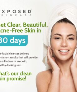 Exposed Skin Care Acne Facial Cleanser - Gentle Face Wash with Salicylic Acid for Acne Prone Skin - Pore Clarifying Acne Treatment for All Ages, Skin Types 15 71OASg2UKtL