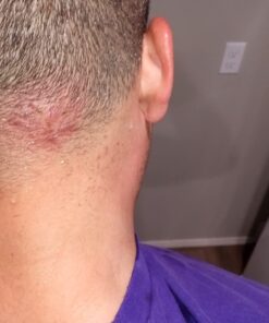 AROMAVITA Facial Acne Control Soap - Oregano Oil and Argan Oil Soap - Natural Cleansing Face Wash - Topical Skin Cleanser Soap 19 71OSrCLRbQL