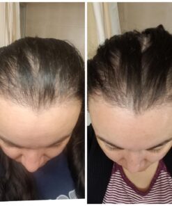 Amazing Formulas Biotin 10000mcg 200 Veggie Capsules Supplement | Non GMO | Gluten Free | Made in USA | Suitable for Vegetarians 200 Count (Pack of 1) 30 71OZUQOjDsL