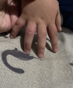 SilverSeal Burn and Wound Dressing | Hydrogel Pads with X-Static Silver | Soothing, Moist & Protective | Burns, Cuts & Wounds | 4 Sterile Dressings 4"x4" Patch (4 Count) 54 71OsTrGzibL