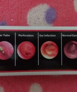 Third Generation Dr Mom Slimline Stainless LED Pocket Otoscope with Soft White Natural Hue Light Spectrum in Hard Travel Case Includes Lighted Ear Wax curettes 34 71OzgpD8dhL