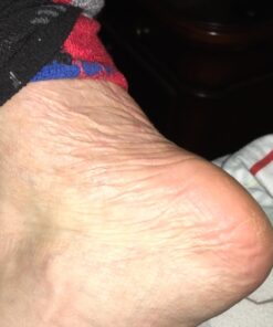 Amope Pedi Perfect Electronic Foot File, Dual-Speed Callus Remover (with Diamond Crystals) for Feet (Extra Coarse - Pink Gadget). -Perfect for In-home Pedicure for Baby Smooth Feet. Battery Operated 48 71PGBf9EX3L